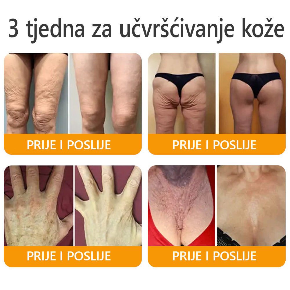 Proizvedeno i poslano iz Hrvatske ✅ 𝐀𝐖𝐙𝐋𝐎𝐕𝐄® Sveobuhvatna krema s pčelinjim otrovom | ZADNJI DAN 80% POPUSTA🌊🌊