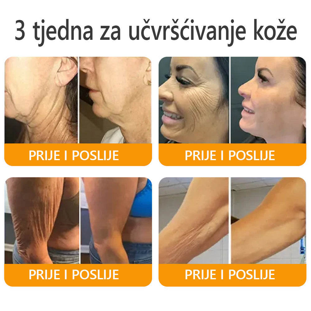 Proizvedeno i poslano iz Hrvatske ✅ 𝐀𝐖𝐙𝐋𝐎𝐕𝐄® Sveobuhvatna krema s pčelinjim otrovom | ZADNJI DAN 80% POPUSTA🌊🌊